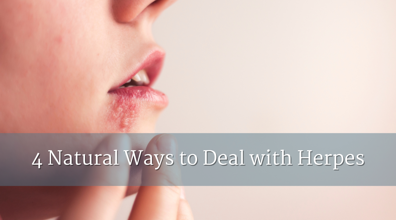 4 Natural Ways to Deal with Herpes